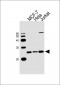 MGMT Antibody